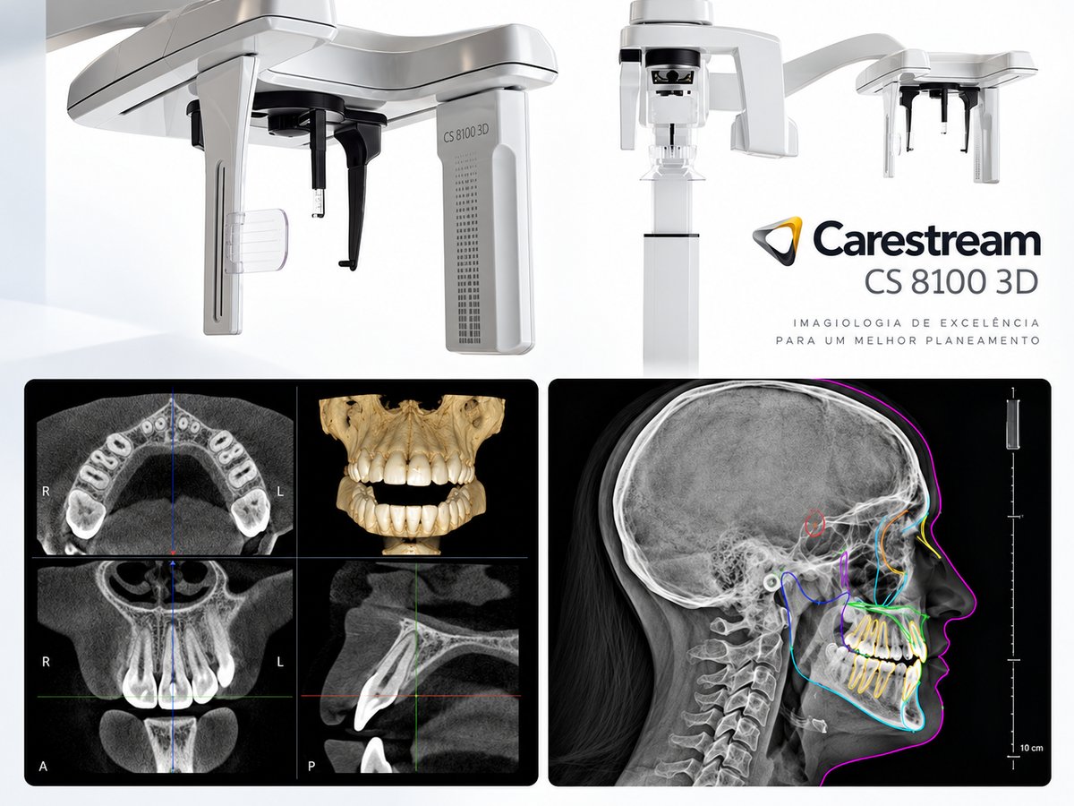 Equipamento Carestream CS 8100 3D com exemplos de imagem: cortes de TAC dentária 3D (CBCT) e telerradiografia de perfil com traçado cefalométrico