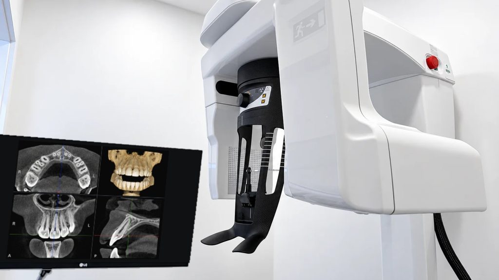 Equipamento de TAC dentária 3D (CBCT) Carestream CS 8100 na sala de imagiologia da Lusocare, com o monitor a mostrar cortes 3D