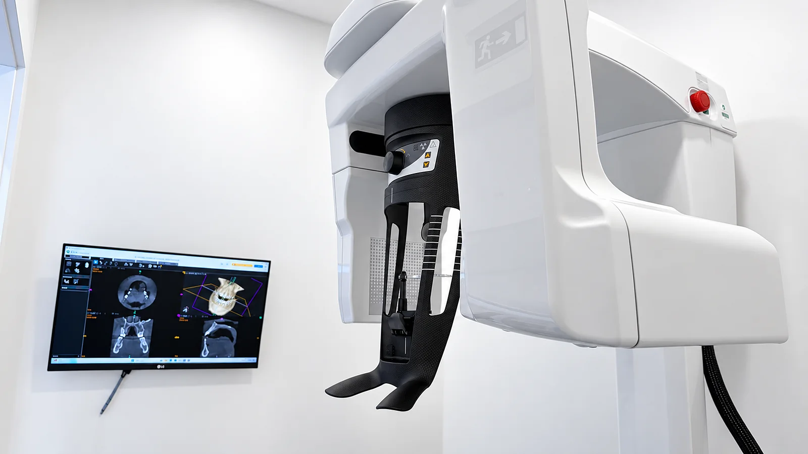 Equipamento CBCT 3D da Lusocare Montijo, com exame tridimensional no ecrã
