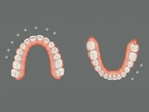 Plano digital Smile Aligners Lusocare: vista das arcadas superior e inferior